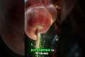 The Appendix: Not So Useless After